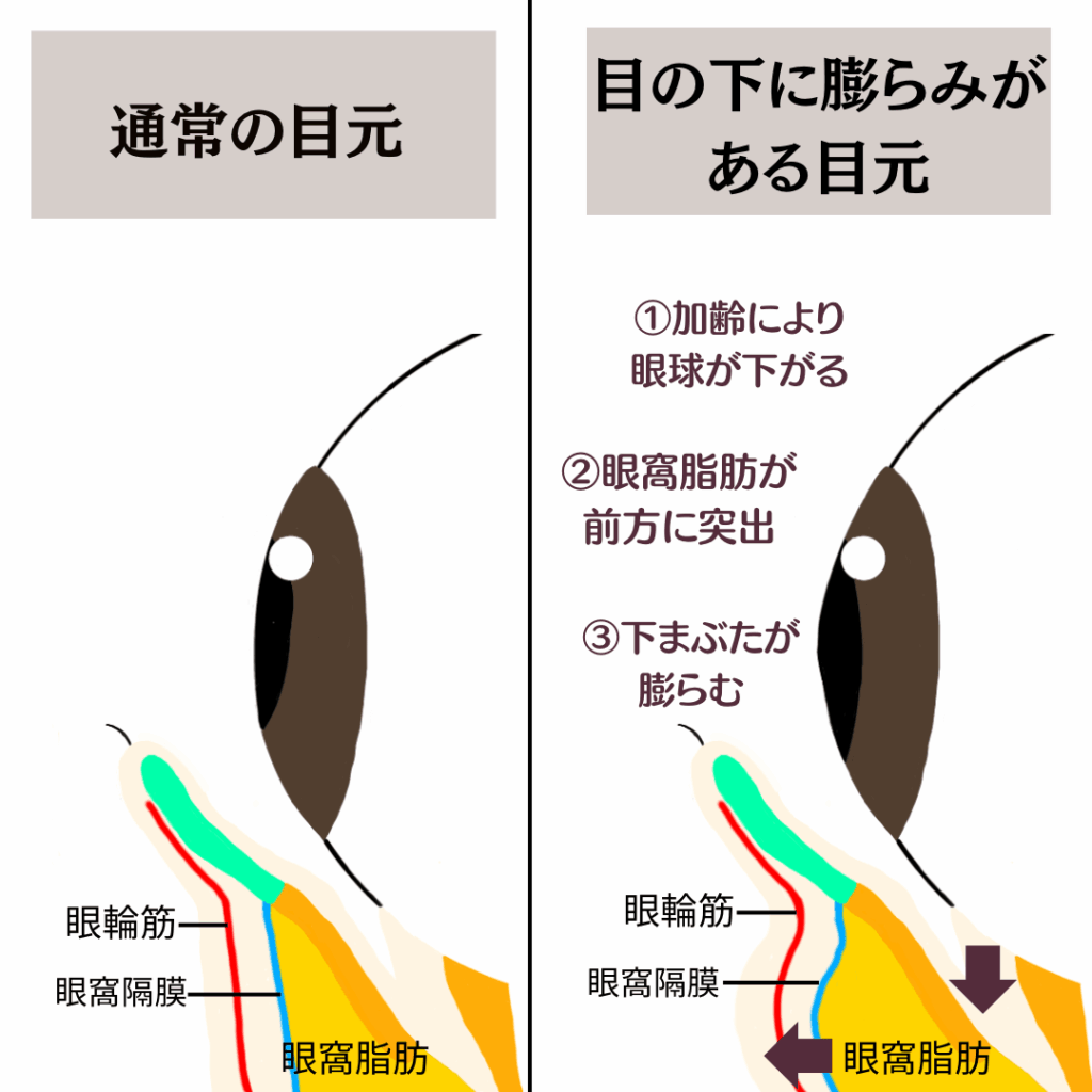 図画像